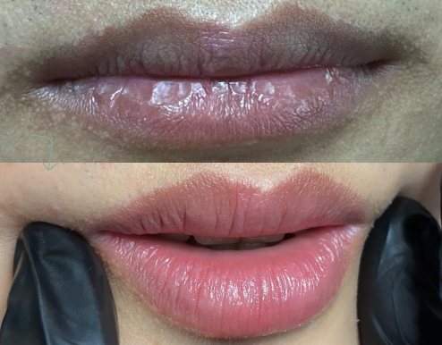 Kết quả tự nhiên, giữ vẻ nam tính