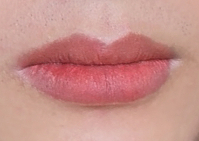 Môi nam ngay sau khi khử thâm - tươi sáng, không đỏ son