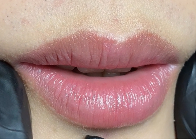 Môi nam sau 7 ngày - hồng nhẹ, tươi tự nhiên, không ai biết đã làm