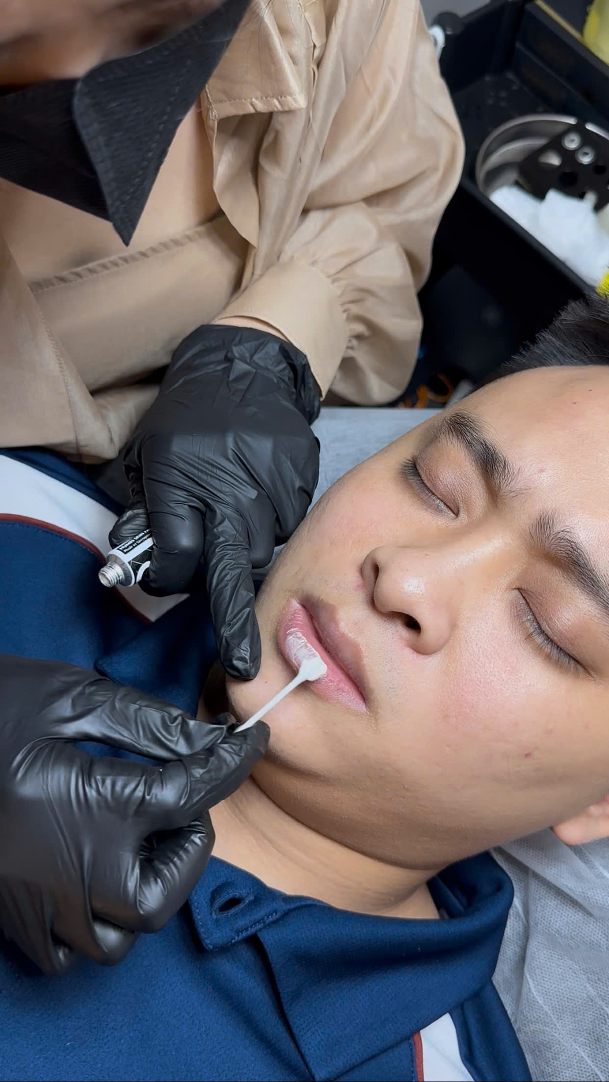 Khử thâm môi bước 2 - Lumi Beauty