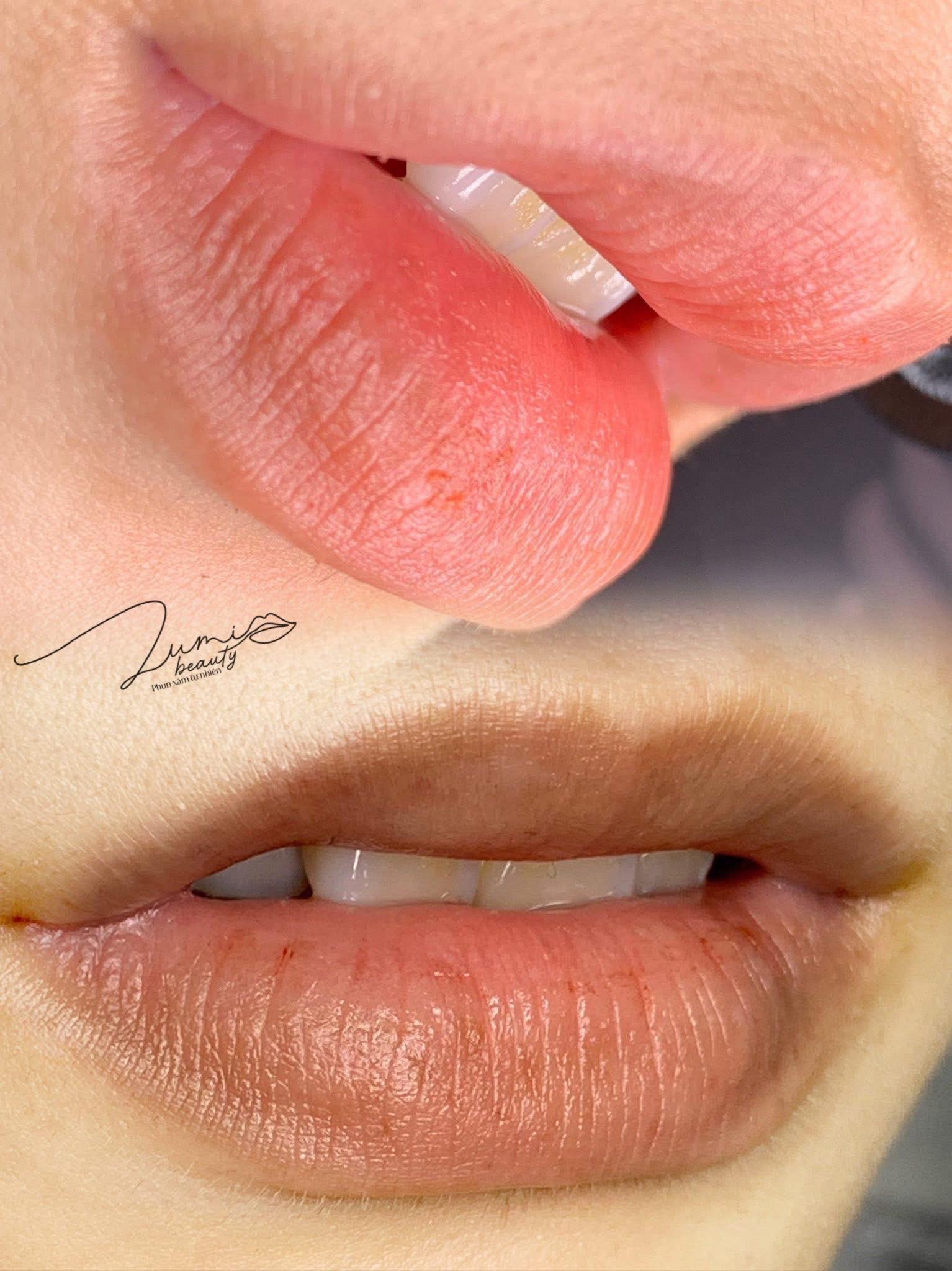 Lumi Beauty gallery 14