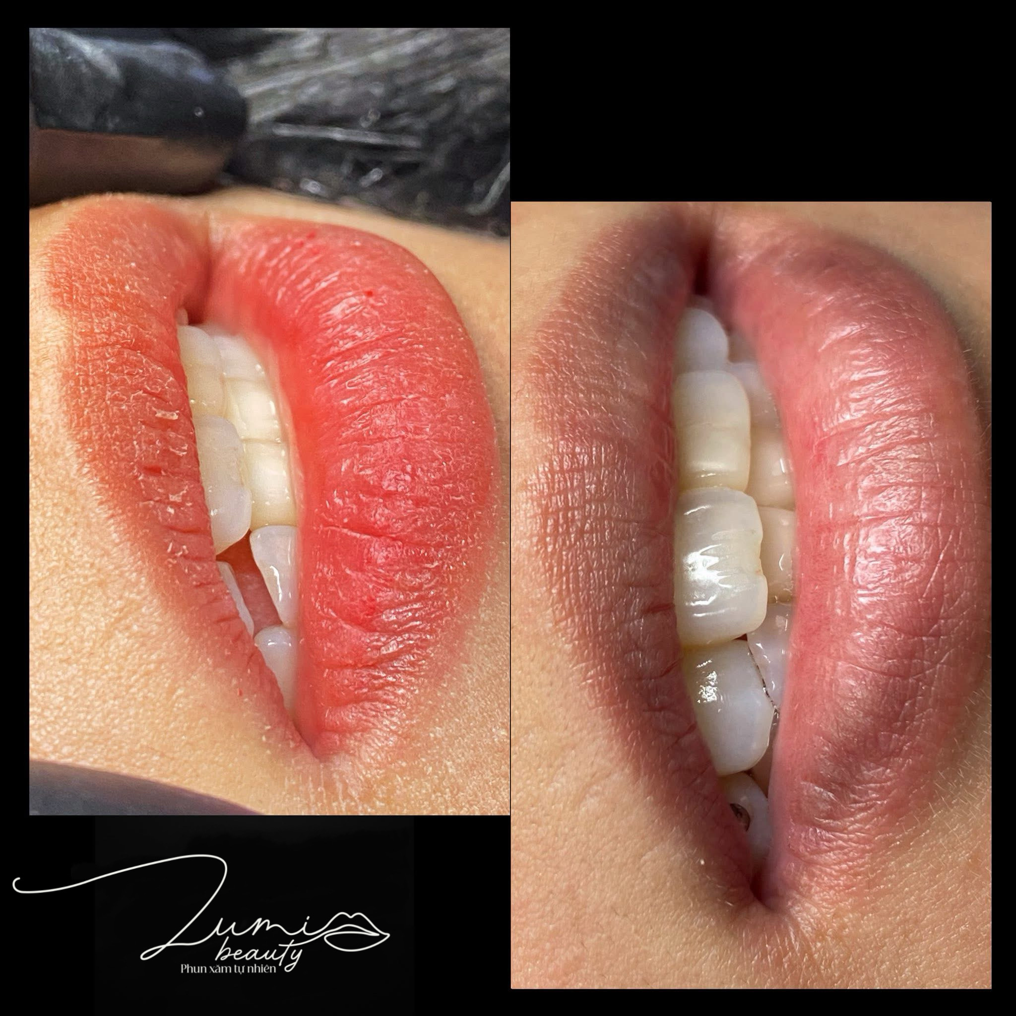 Lumi Beauty gallery 15